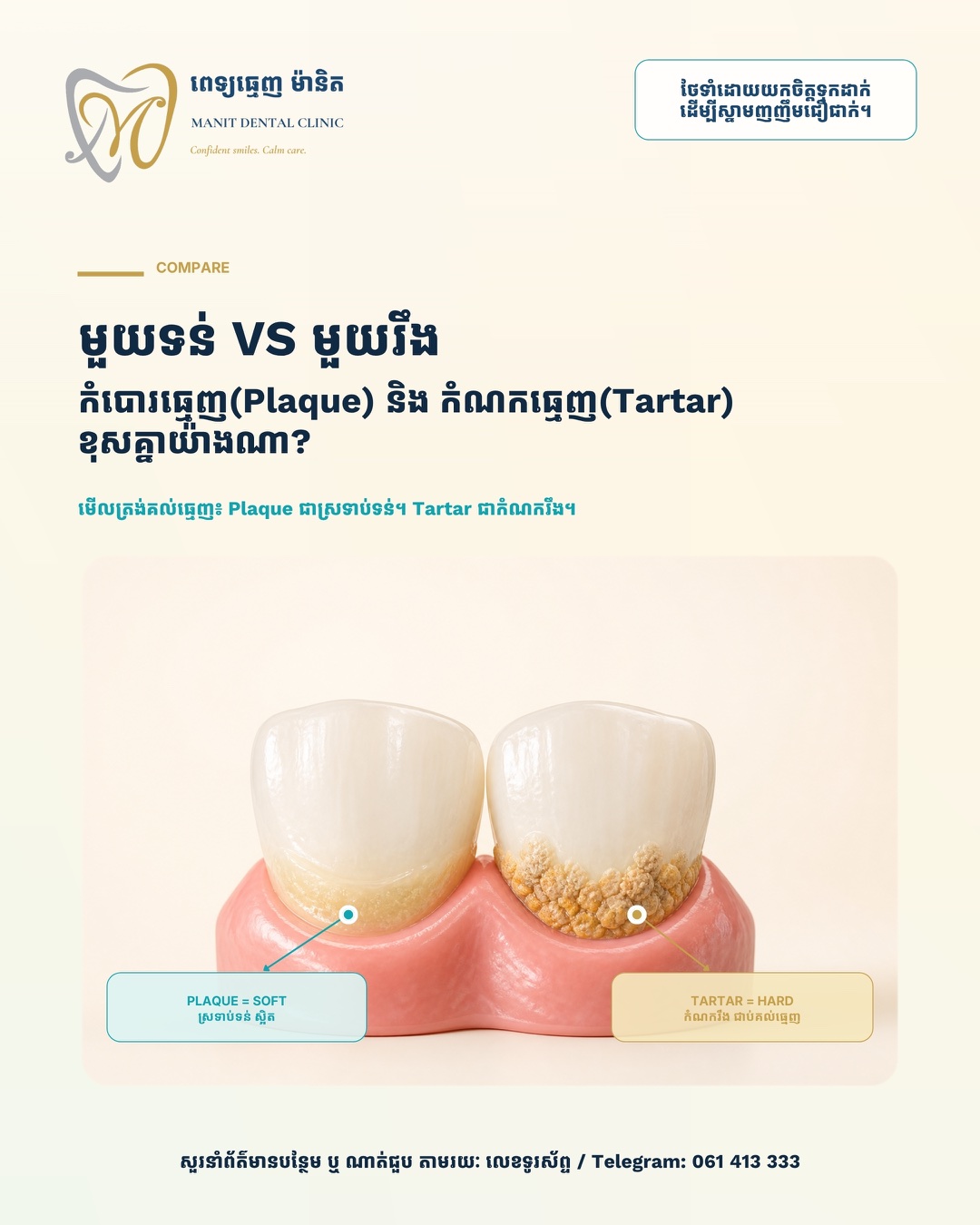 Manit guide comparing soft plaque with hardened tartar